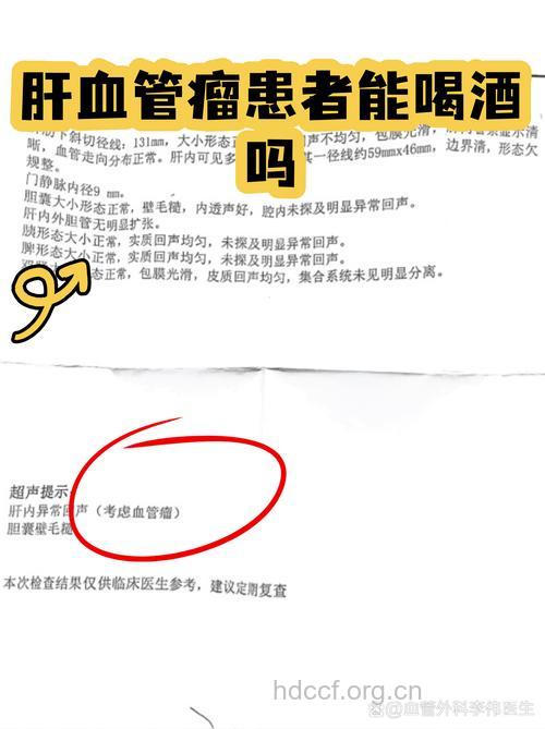喝酒对肝血管瘤患者的危害