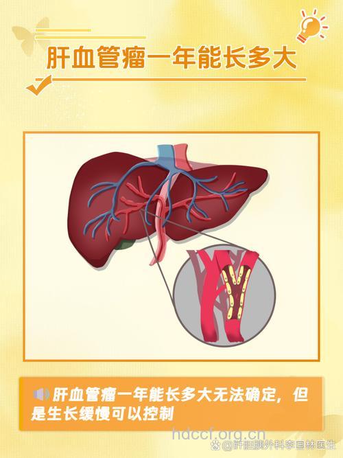肝脏血管瘤有哪些分类