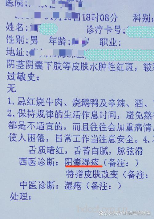 阴茎牛皮癣是怎么回事？