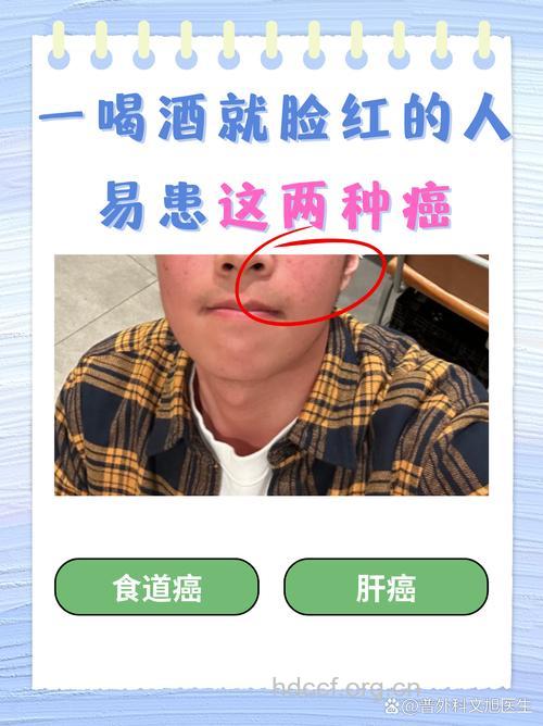 喝酒脸红易得食道癌