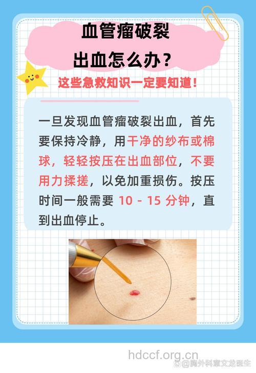 血管瘤破了如何处理