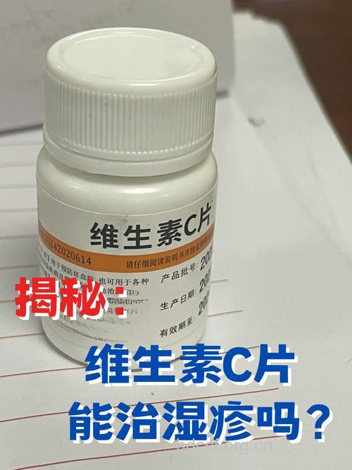 维生素C能治疗牛皮癣吗