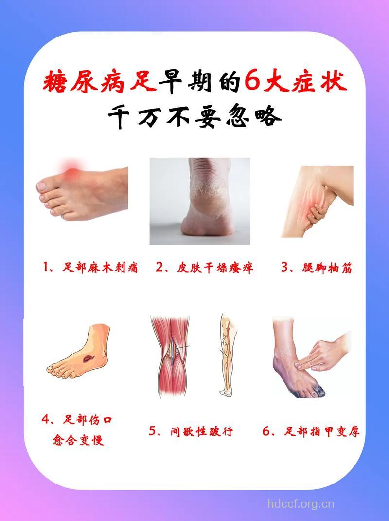 早期糖尿病的症状是什么呢