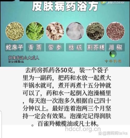 药浴治疗银屑病对病症有何作用