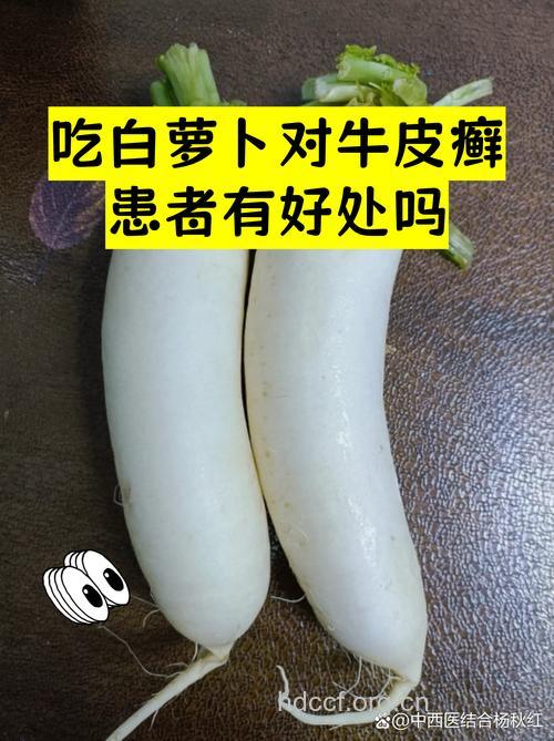 牛皮癣患者适合食用哪些蔬菜