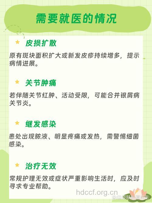 导致牛皮癣的产生因素是什么