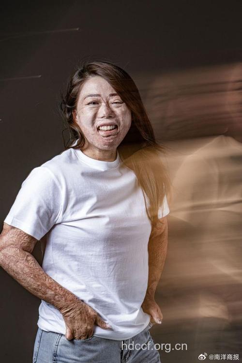 肾虚 女人变丑的罪魁祸首
