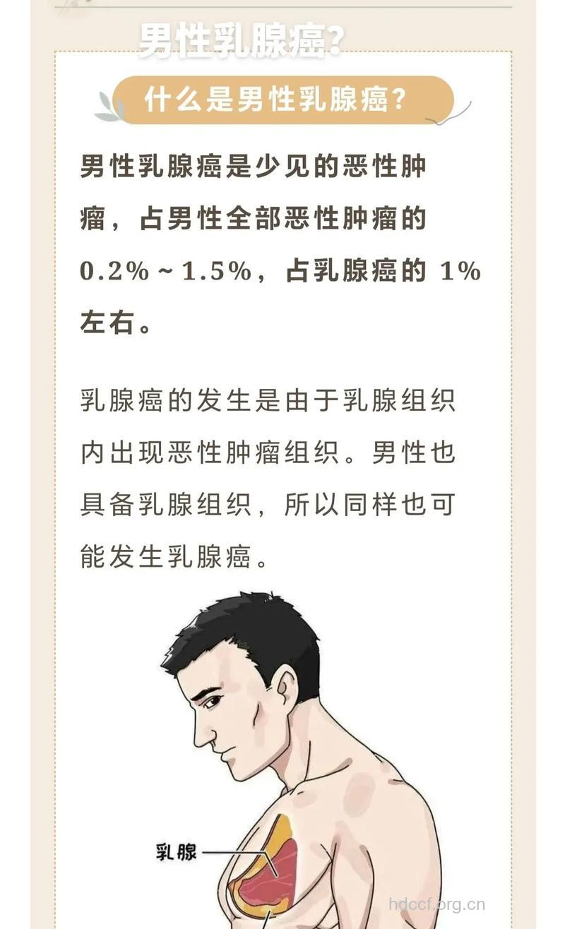 诱发男性乳腺癌的主要原因