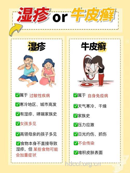 银屑病与季节有何关系？