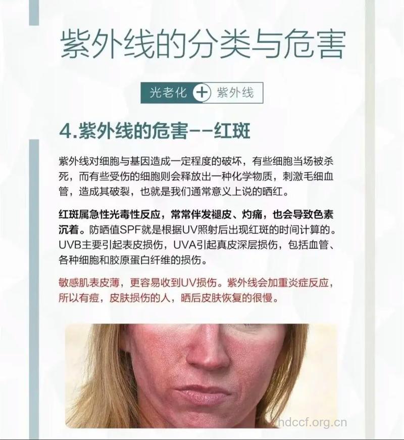 紫外线致癌是真的吗