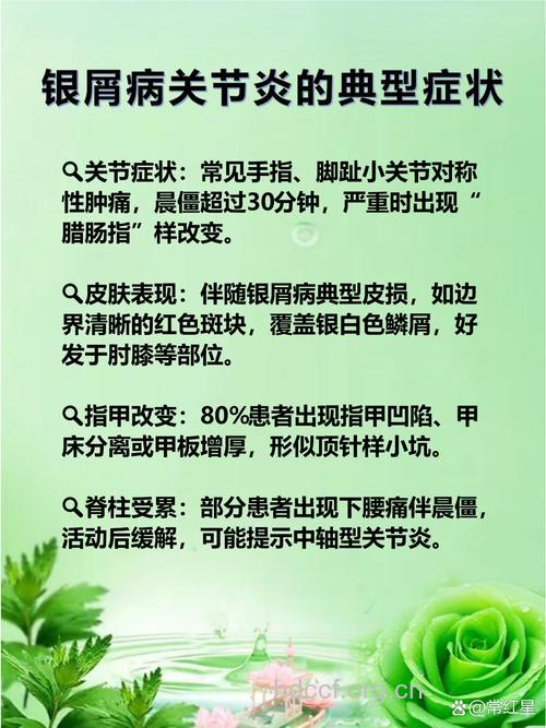 银屑病性关节炎的概况