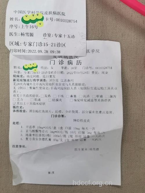 神经性皮炎的诊断治疗