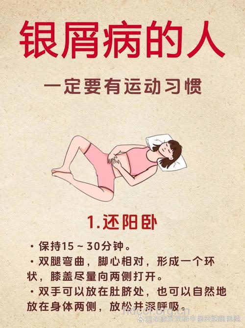 银屑病患者应多运动