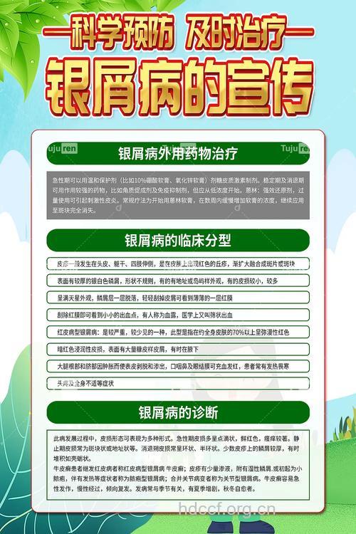 银屑病的百科名片