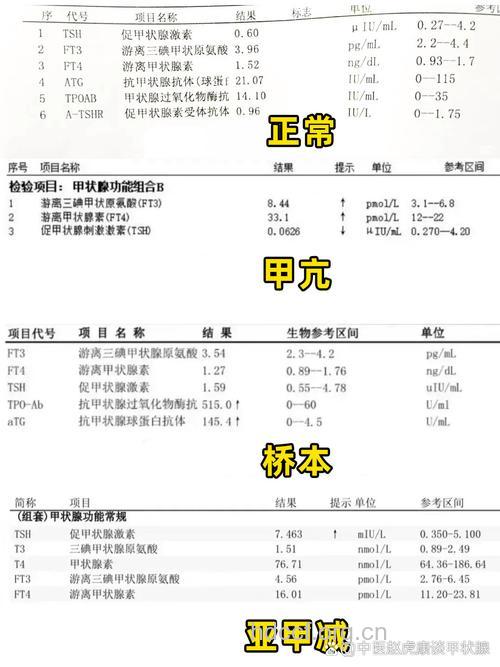 教你如何解读甲亢的化验单