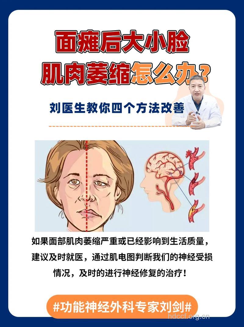 脸部肌肉萎缩该怎么办