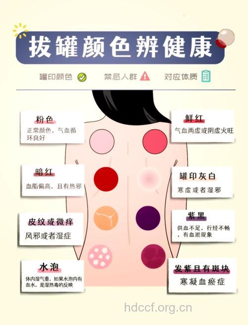 拔罐出水泡怎么回事 原因在这里