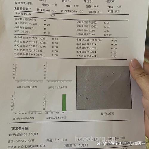 精液检查化验单怎么看