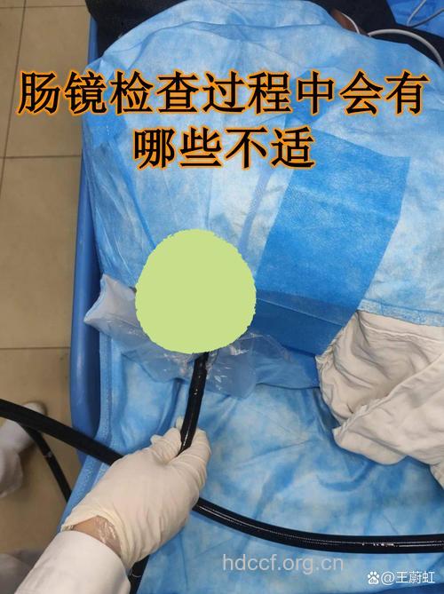 年过半百每年做一次肠镜检查