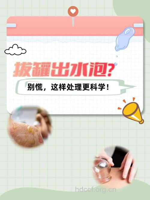 拔罐出现水泡是好是坏 如何避免水泡