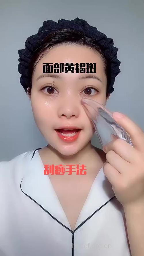 脸上长了黄褐斑 刮痧疗法能治疗