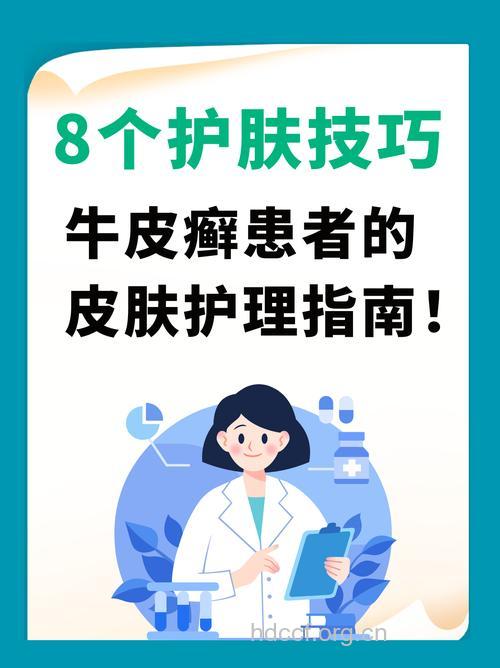 牛皮癣患者日常如何护理