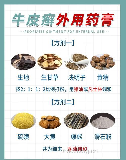 银屑病的中药治疗方法