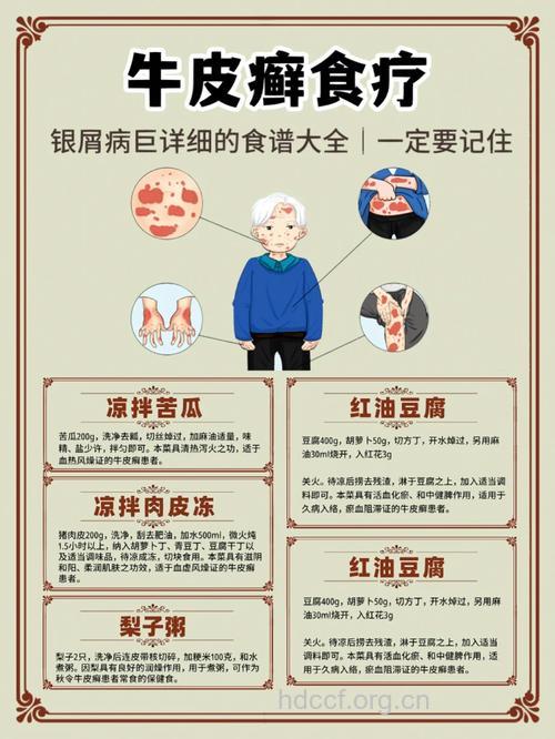 银屑病的辨证分型与食疗