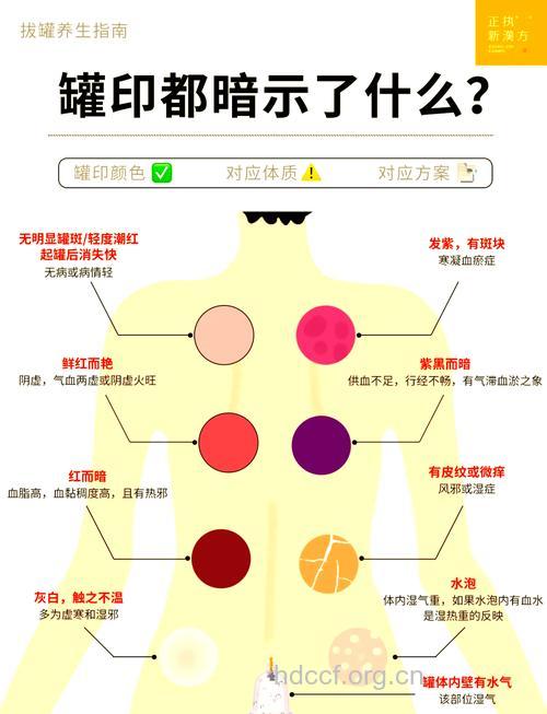 拔罐后出现的罐印颜色 代表了什么