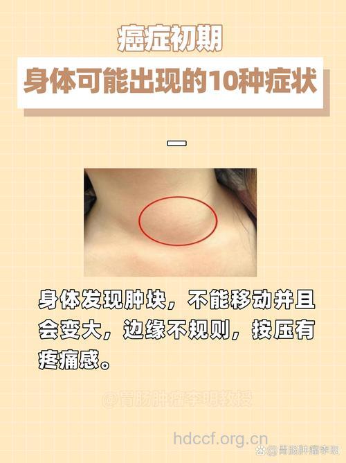 癌症前期有哪些症状
