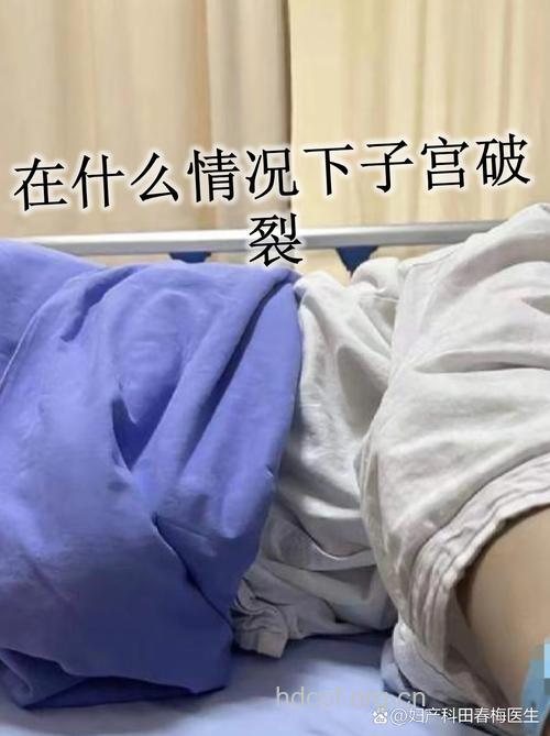 腹腔镜手术后子宫破裂风险更高吗?
