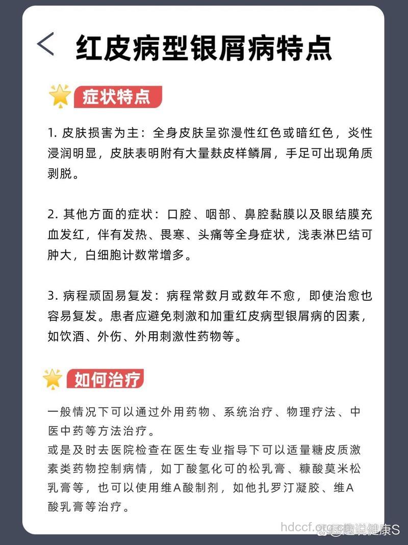 红皮病型银屑病治疗论