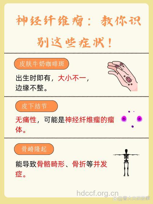 皮肤神经瘤症状介绍
