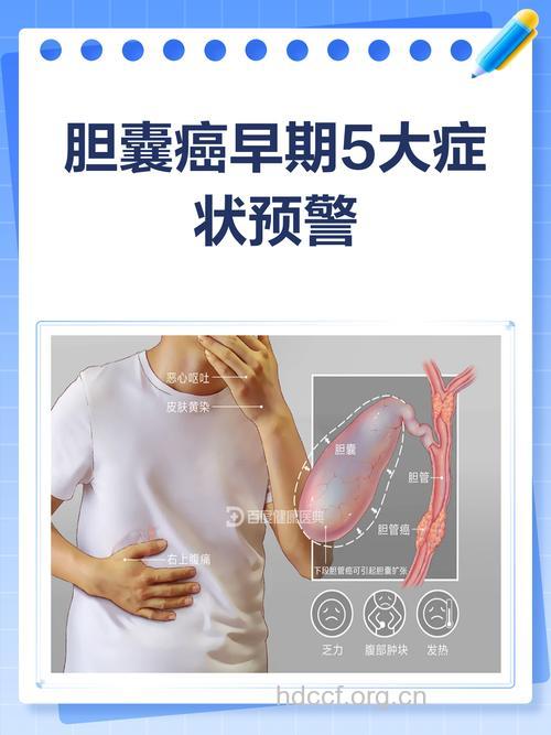 早期胆囊良性肿瘤的症状