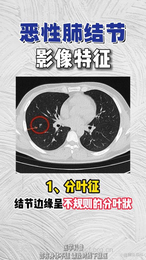 肺良性肿瘤的症状特征是什么