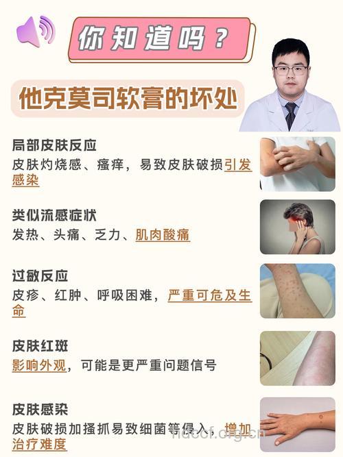 激素治牛皮癣须警惕副作用