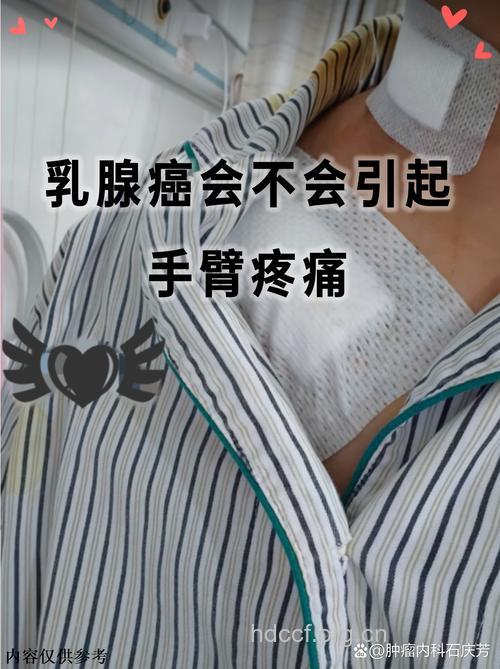 乳腺良性肿瘤会不会痛