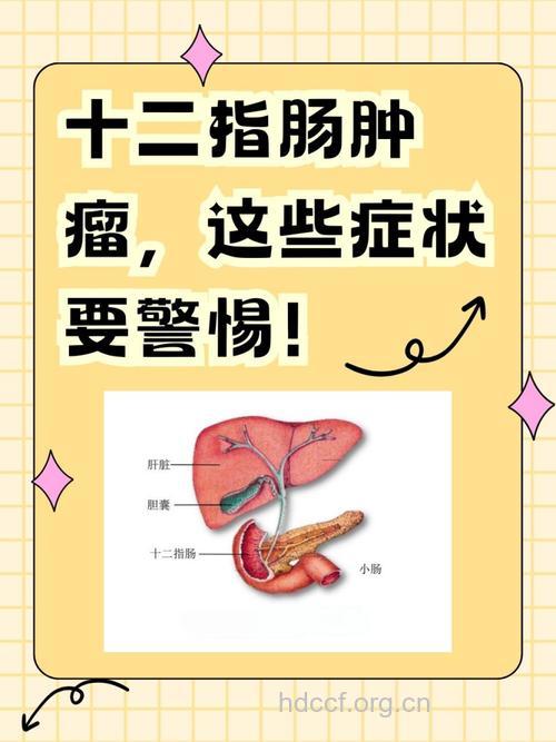十二指肠良性肿瘤的典型症状