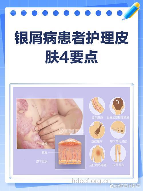 银屑病患者怎么看治疗广告
