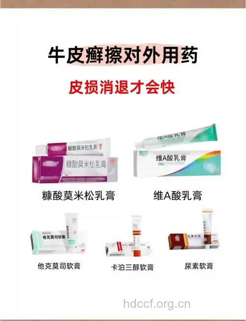科学用药治疗牛皮癣