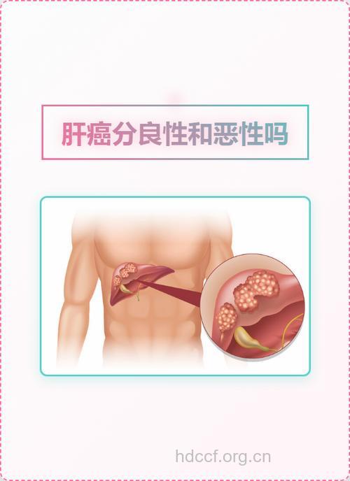 肝部良性肿瘤的预防厕所