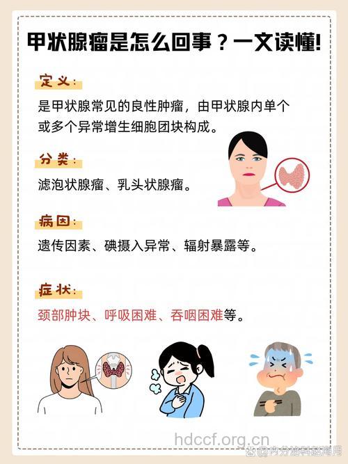 甲状腺良性肿瘤的病因