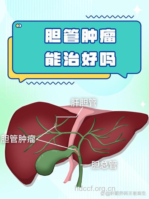 为何会得胆囊良性肿瘤