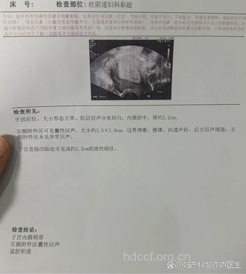 子宫内膜病理检查结果