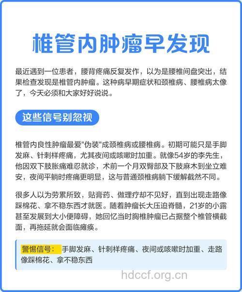椎管内肿瘤有哪些误诊原因