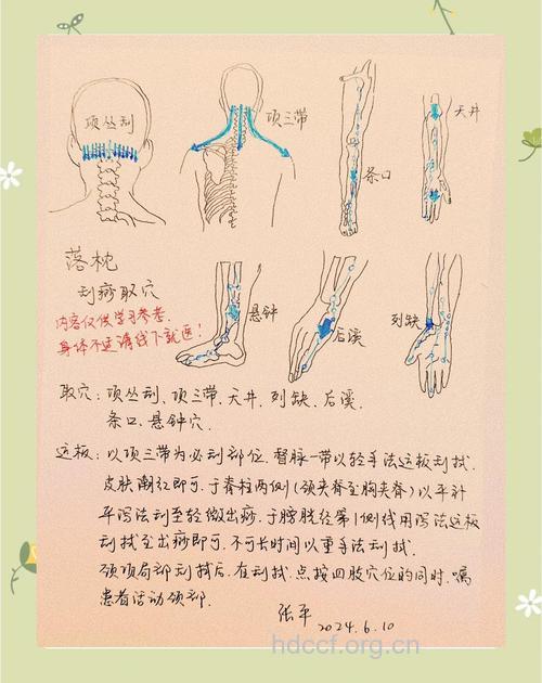 刮痧能治疗落枕吗 落枕的刮痧疗法