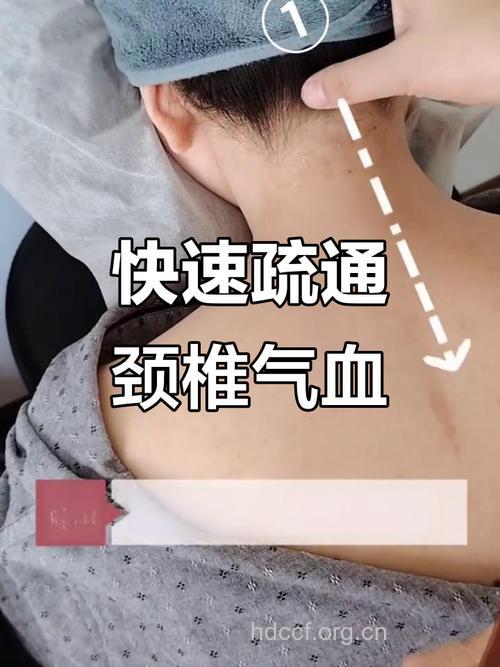 刮痧能治疗颈椎病吗 颈椎病的刮痧疗法