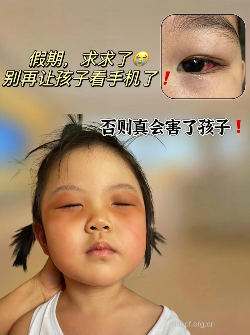 儿童使用手机可能导致肿瘤