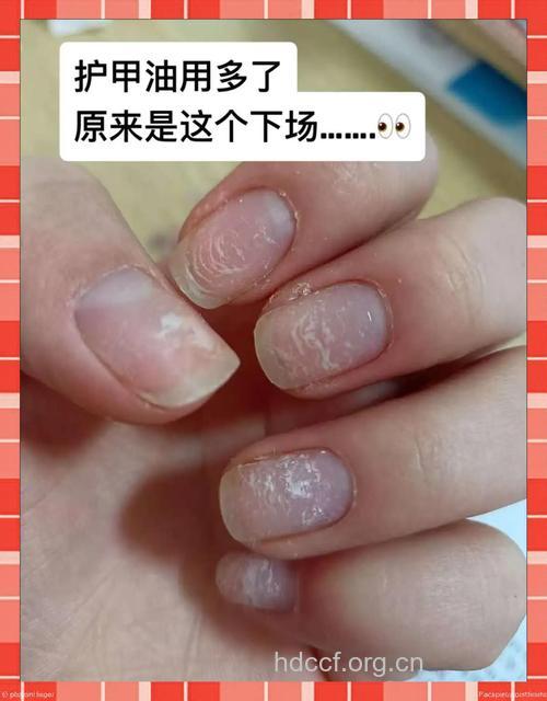 劣质指甲油可能会致癌