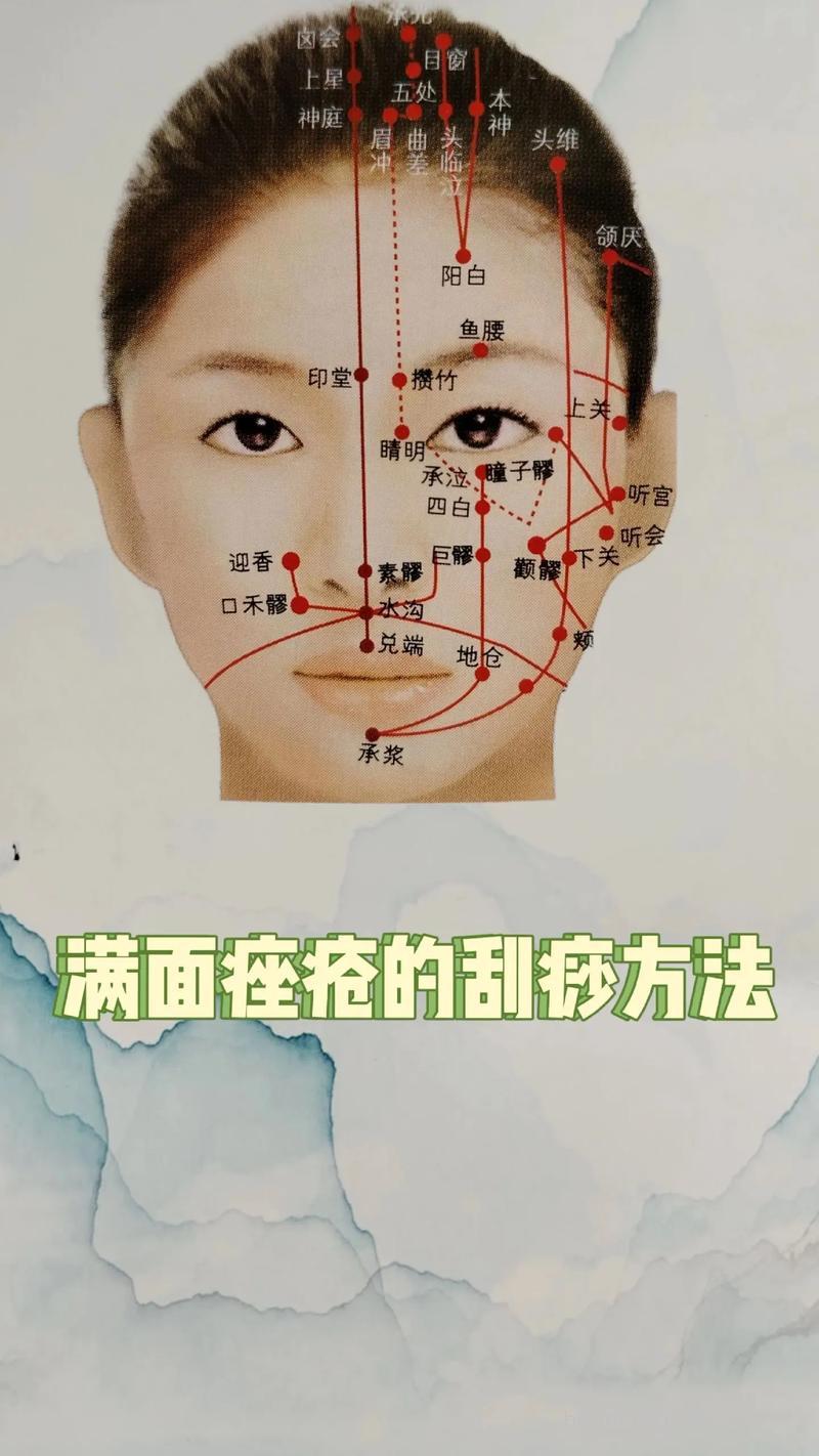 刮痧能治痤疮吗 痤疮的刮痧疗法